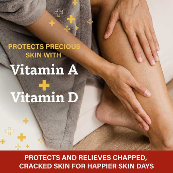 A+D First Aid Healing Ointment - Moisturizing Skin Protectant for Dry Cracked Heels, Elbows, Hands and Lips - Use After Hand Washing, Packaging May Vary, Multicolor  1.5 oz Tube