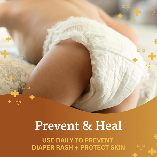 A+D Original Diaper Rash Ointment, Baby Skin Protectant With Lanolin and Petrolatum, Seals Out Wetness, Helps Prevent Diaper Rash, 4 Ounce Tube, Packaging May Vary