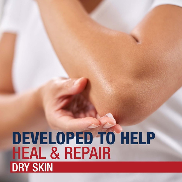 Aquaphor Healing Ointment - Dry Skin Moisturizer - Hands, Heels, Elbows, Lips - 7 oz. Tube