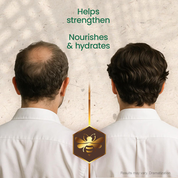 Tio Nacho Mexican Herbs Shampoo, Strengthening Hair Care with Royal Jelly, Ginseng, Wheat and Jojoba Oil, Honey Scented-14 Fl Oz