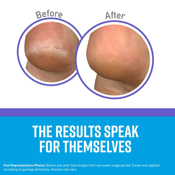 O'Keeffe's Foot Cream Exfol 3oz