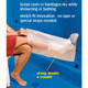 Carex EZ Stretch Cast Cover and Cast Protector for Shower - Waterproof Cast Cover Leg