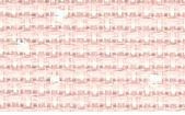 Powder Pink / 37064259