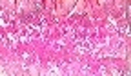 Opalescent Pink / ES35