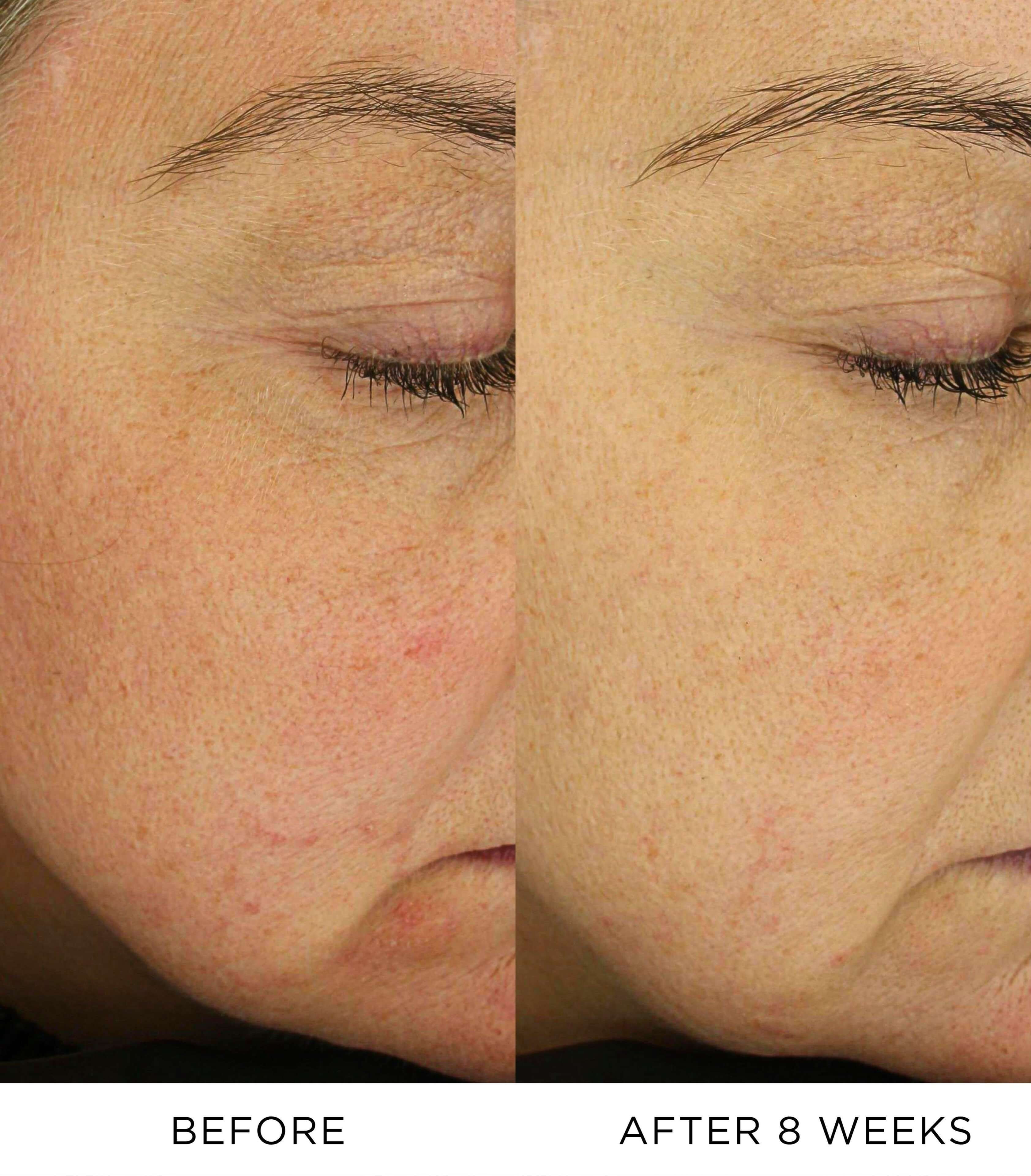 Nourishing Lift Oil 3