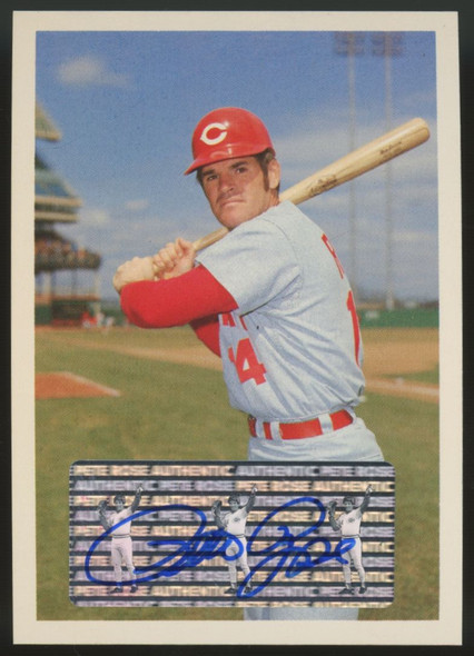 1985 Topps Renata Galasso Pete Rose Auto #98 "C"