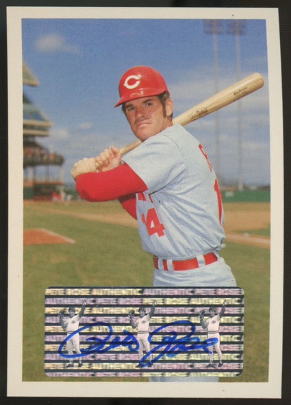 1985 Topps Renata Galasso Pete Rose Auto #98 "B"