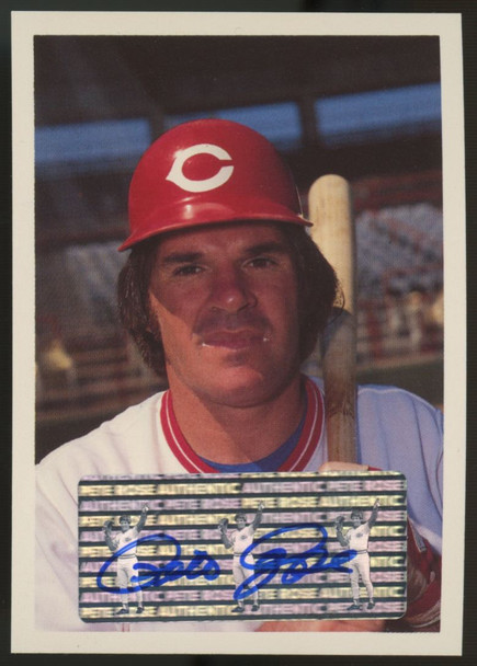 1985 Topps Renata Galasso Pete Rose Auto #107 "B"