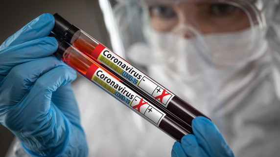 Coronavirus Workplace Health & Safety – What you need to know 