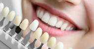 Guide de Blanchiment Dentaire : Comment Choisir le Meilleur Produit Pour Vous?