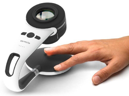 3gen dermlite foto x with nailio digital portable dermascope microscope