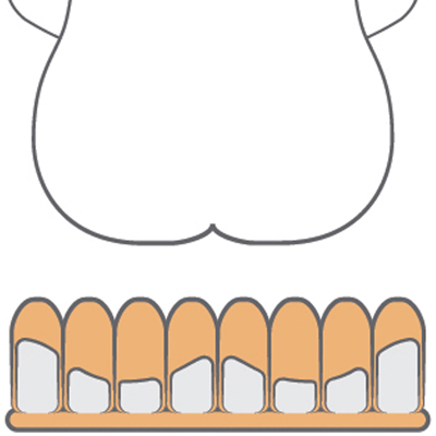 Diagram of someone sitting on Star Stabil Air Seat Cushion