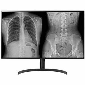 LG 32HL512D-B 32" Class 4K LCD Monitor - 16:9 - TAA Compliant - 31.5" Viewable - In-plane Switching (IPS) Technology - 3840 x 2160 - 450 Nit Typical - 5 msGTG (Fast) - HDMI - DisplayPort