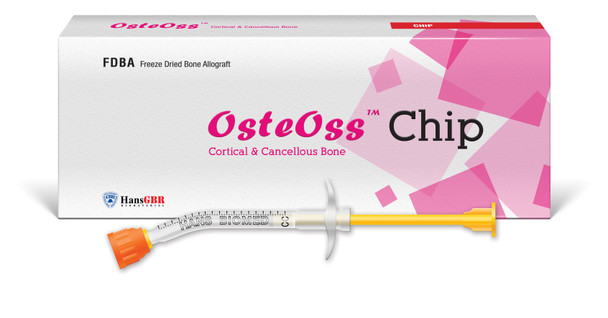 OsteOss Chip