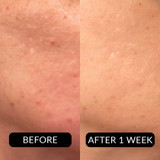 ProCorrective Clear-Control Moisturizer