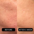 ProCorrective Clear-Control Moisturizer
