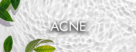 Acne Products