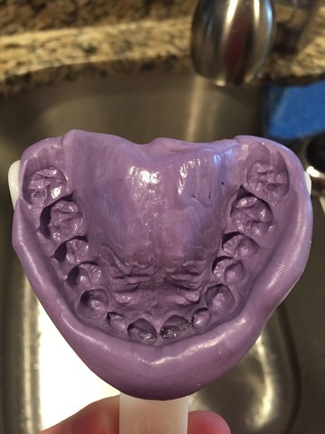 Practice impression example