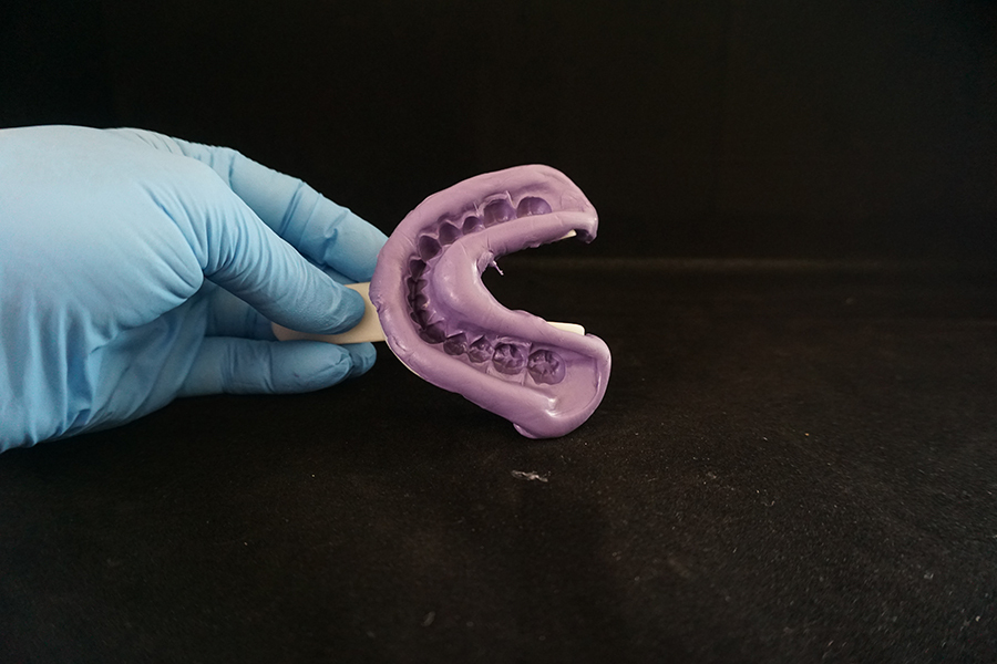 Lower impression deep teeth