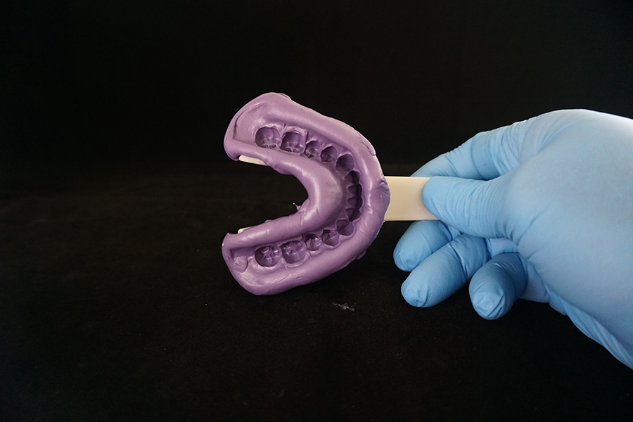 Lower impression gums captured