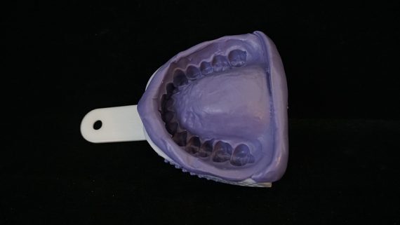 Good upper impression centered teeth