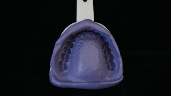 Good upper impression deep teeth