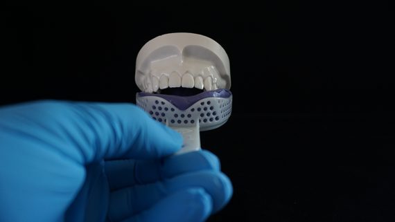 Remove tray