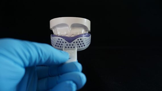 Insert tray over upper teeth