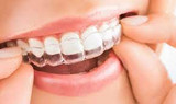 Problems with Invisalign Orthodontic Treatment