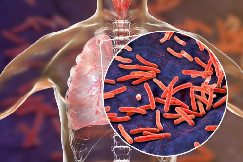 Tuberculosis in Dentistry: 2 hours