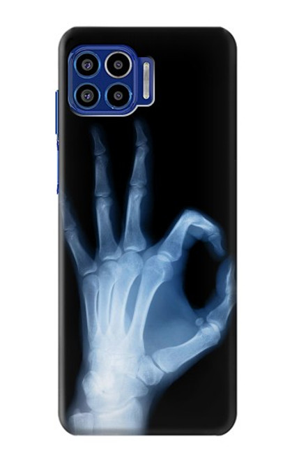 W3239 X-Ray Geste de la main OK Etui Coque Housse et Flip Housse Cuir pour Motorola One 5G