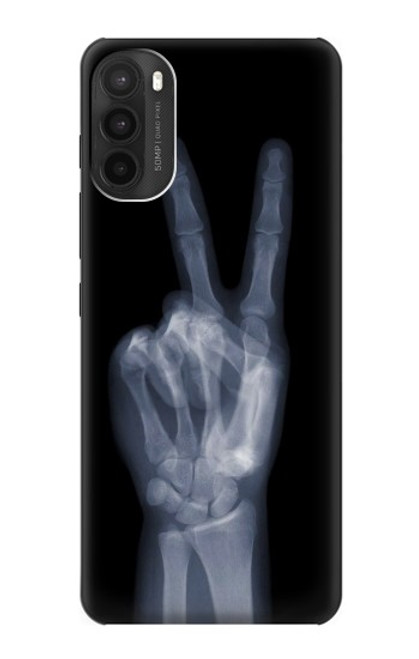 W3101 X-ray doigts Signe de paix Etui Coque Housse et Flip Housse Cuir pour Motorola Moto G71 5G