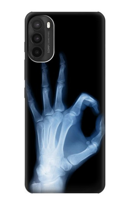 W3239 X-Ray Geste de la main OK Etui Coque Housse et Flip Housse Cuir pour Motorola Moto G71 5G