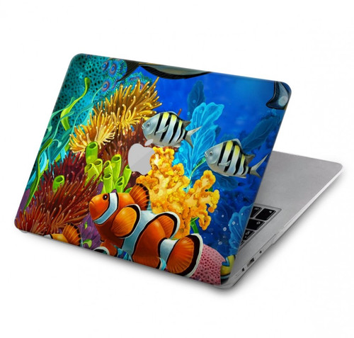 W2568 Mer Poissons marins Coraux Sous-marine Océan Etui Coque Housse pour MacBook Air 13″ (2022,2024) - A2681, A3113