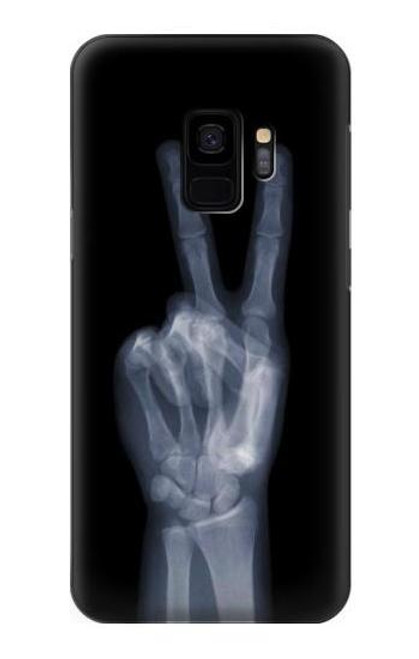 W3101 X-ray doigts Signe de paix Etui Coque Housse et Flip Housse Cuir pour Samsung Galaxy S9