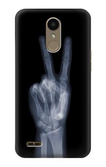 W3101 X-ray doigts Signe de paix Etui Coque Housse et Flip Housse Cuir pour LG K10 (2018), LG K30