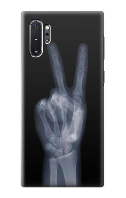 W3101 X-ray doigts Signe de paix Etui Coque Housse et Flip Housse Cuir pour Samsung Galaxy Note 10 Plus