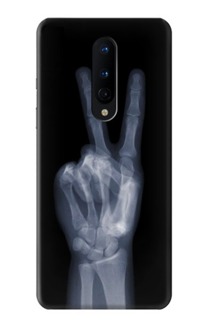 W3101 X-ray doigts Signe de paix Etui Coque Housse et Flip Housse Cuir pour OnePlus 8