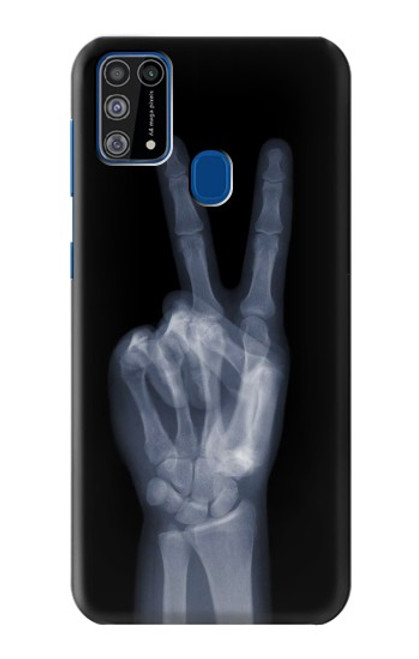 W3101 X-ray doigts Signe de paix Etui Coque Housse et Flip Housse Cuir pour Samsung Galaxy M31