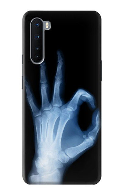 W3239 X-Ray Geste de la main OK Etui Coque Housse et Flip Housse Cuir pour OnePlus Nord