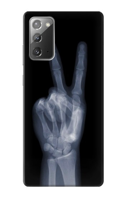 W3101 X-ray doigts Signe de paix Etui Coque Housse et Flip Housse Cuir pour Samsung Galaxy Note 20