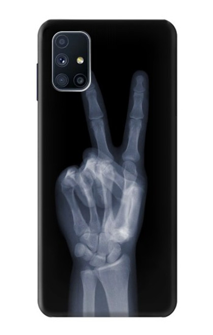 W3101 X-ray doigts Signe de paix Etui Coque Housse et Flip Housse Cuir pour Samsung Galaxy M51