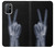 W3101 X-ray doigts Signe de paix Etui Coque Housse et Flip Housse Cuir pour OnePlus 8T