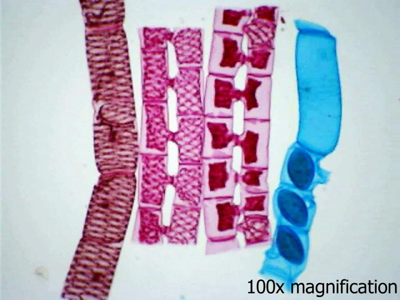 spirogyra microscope slide labeled