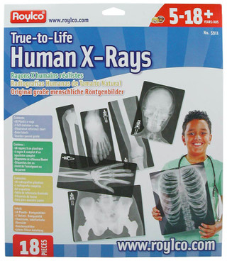 Life Size Human X-Rays Set