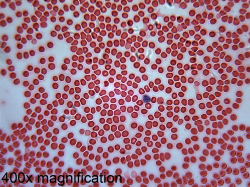 Human blood slide, Wright's stain, smear