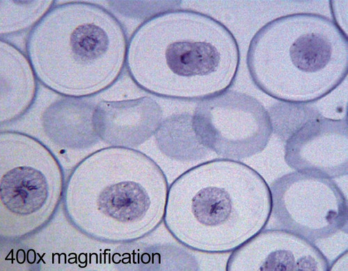 Ascaris (Roundworm) mitosis slide