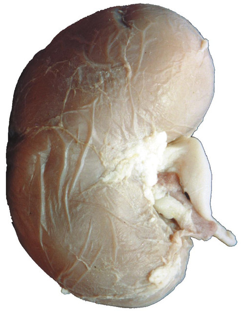 Sheep Kidney Dissection Specimen | Learn Human Anatomy