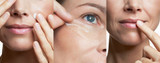 Dermosthetique