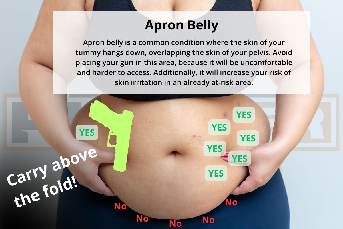 Apron belly, also called mother's stomach, mother's apron, or pannus: the tissue of the abdomen hangs down, creating an overlap of negative space. Carry higher, above the fold, instead of trying to carry in this area.